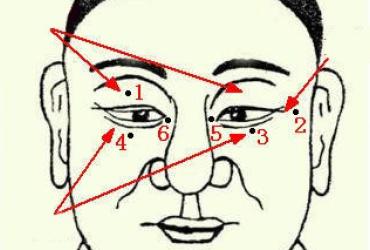 Nốt ruồi quanh mắt có ý nghĩa gì?