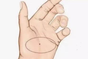 10 Nốt Ruồi Tốt Ở Bàn Tay, Bạn Có Không?