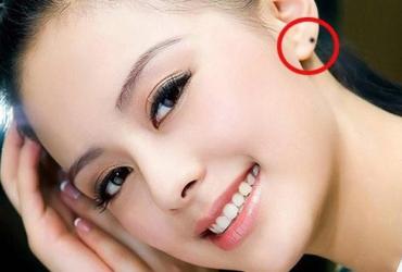Những sự thật thú vị về các nốt ruồi ở tai