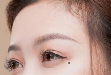 5 Nốt Ruồi Chứng Tỏ Bạn Hợp Kinh Doanh, Có Lộc Buôn Bán