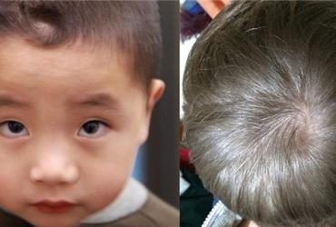 Xem Xoáy Tóc Trẻ Em Để Biết Tương Lai Vận Mệnh Đứa Trẻ