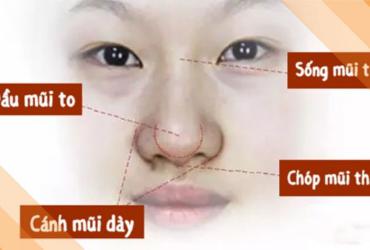 Mũi Củ Tỏi - Tuy không đẹp nhưng lắm tiền